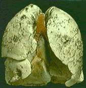 Lung